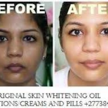 Permanent Skin Lightening Skin Whitening Products  27738432716